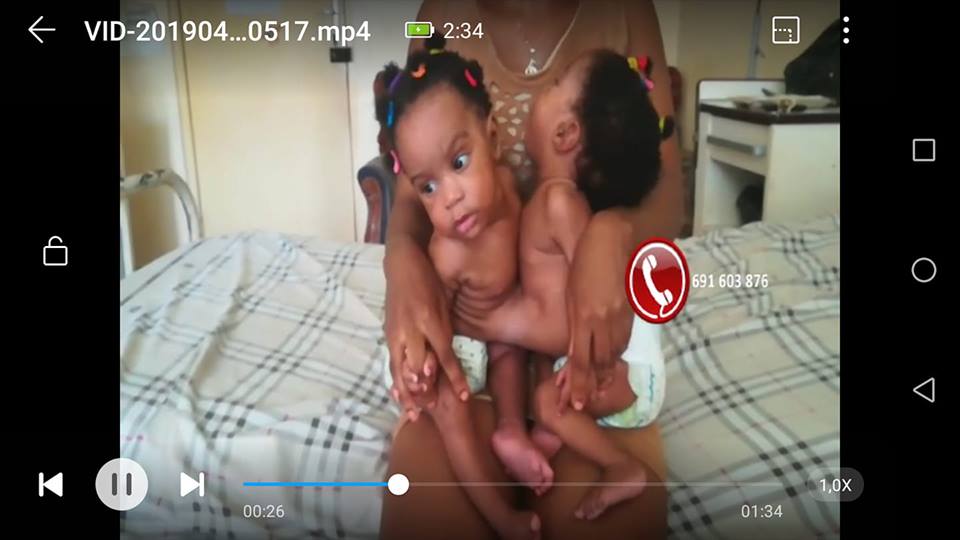 Jacques Marcel Itiga Itiga (@itigson) on Twitter photo Des #siamois en détresse à #HGOPY
Ces magnifiques petites filles ont besoin de votre aide <a href="/DrManaouda/">Dr MANAOUDA MALACHIE</a> <a href="/PR_Paul_BIYA/">President Paul BIYA</a> <a href="/ChantalBIYA_Cmr/">Chantal BIYA</a> <a href="/MincomCameroun/">MINCOM Cameroon</a> <a href="/CamerounTribune/">Cameroon Tribune</a> <a href="/Afreeca1/">Cameroun en direct</a> <a href="/cameroun24/">Cameroun24</a> <a href="/camerbe/">Camer.be</a> Des #siamois en détresse à #HGOPY
Ces magnifiques petites filles ont besoin de votre aide <a href="/DrManaouda/">Dr MANAOUDA MALACHIE</a> <a href="/PR_Paul_BIYA/">President Paul BIYA</a> <a href="/ChantalBIYA_Cmr/">Chantal BIYA</a> <a href="/MincomCameroun/">MINCOM Cameroon</a> <a href="/CamerounTribune/">Cameroon Tribune</a> <a href="/Afreeca1/">Cameroun en direct</a> <a href="/cameroun24/">Cameroun24</a> <a href="/camerbe/">Camer.be</a>