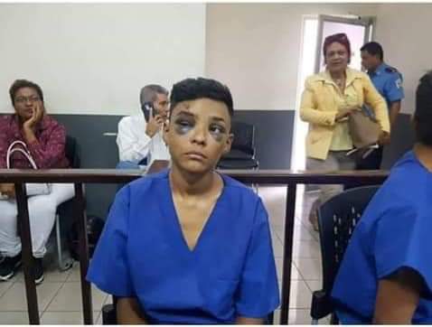 Roxana54755021's tweet photo. @CIDH Jonathan Lopez Tiene 17 Años y fue golpiado y torturado, asi lo yevaron ante un juez
#NIPERDONNIOLVIDO
#SOSNicaragua
#M19A
#RESISTENCIAINDIGENADEMONIMBO
#JONATHANLOPEZ #SOSPresosPoliticos @CIDH @PauloAbrao #MESENI #GIEl @cenidh https://t.co/O0ay5IrJc3