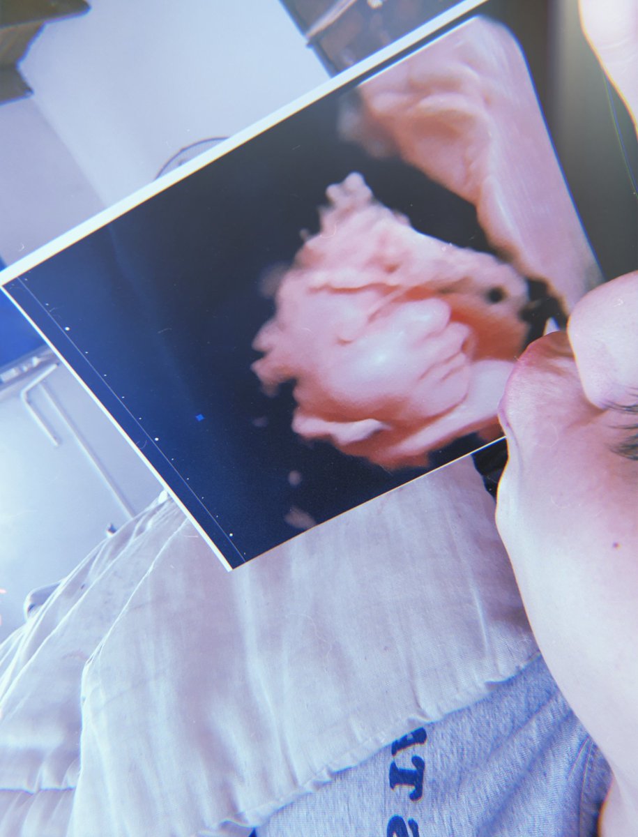 RocioNubee_'s tweet photo. #DiaInternacionalDelBeso ❤👶 https://t.co/TDHshUlsiE
