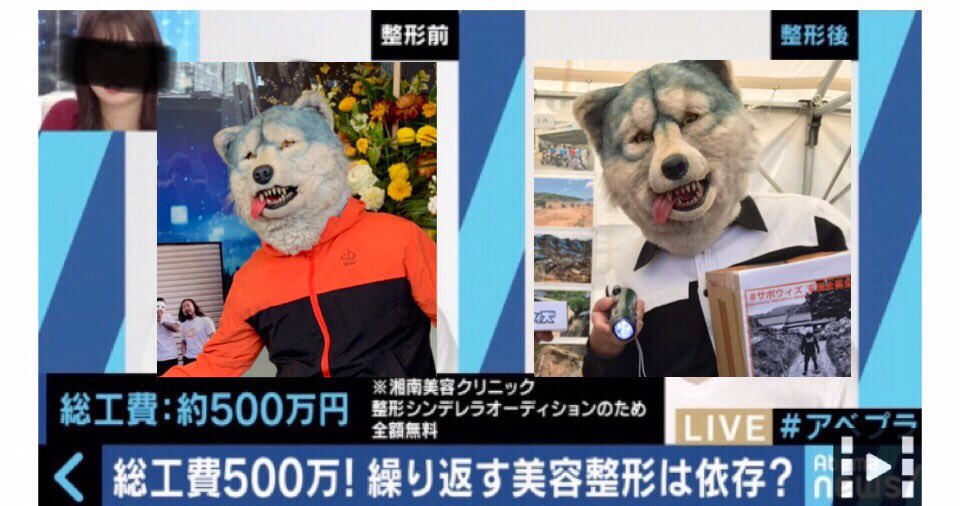 Man With A Mission イヤ 整形シテナイッテ Z 本場前ニ何シテンネン