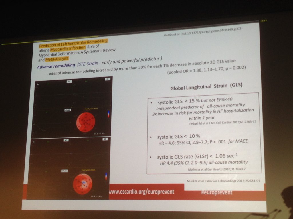 jpschmid_ch's tweet photo. Excellent presentation by R. Ribeiras on the importance of speckle tracking &amp; longitudinal strain for initial assessment before cardiac rehabilitation. Have a look on ESC 365.#europrevent @m_piepoli @SilCastelletti @ESC_Camille @ https://t.co/z3gV5oK3YP