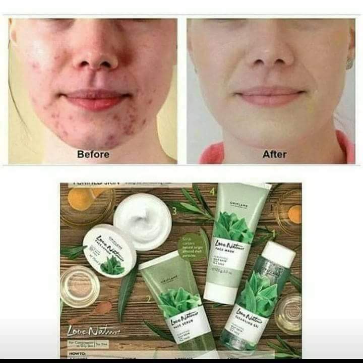 oriflame face cream for pimples