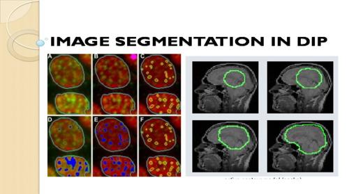 Mtechthesis3's tweet photo. PDE Contour modal development for image segmentation in medical image processing(MPRJ_91)

Read more at :- https://t.co/HpP9iCZLIO https://t.co/rYiQ2qCIV8
