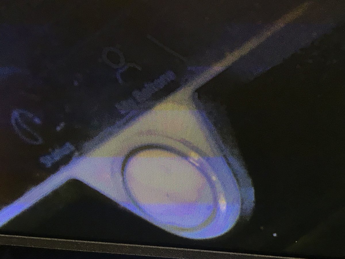 TechManStan's tweet image. I’m not an expert at this but please clean your phone before doing a commercial! You can do better @BeltoneUsa!