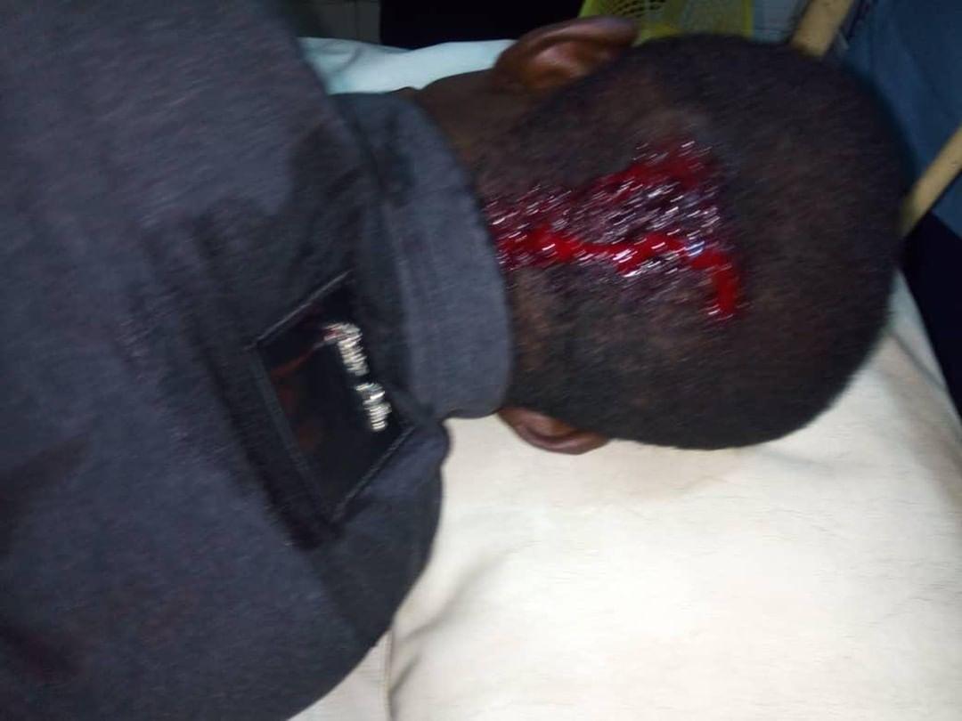 RuggedyBaba's tweet photo. Men of the @PoliceNG have killed another innocent Nigerian youth. They killed a 20yr old girl in Ajegunle while the boy that was with her was also shot and is fighting for his life .
We demand the death sentence
#deathsentenceforKillerpolice
@MBuhari @benmurraybruce @segalink https://t.co/VDRy4YJE53