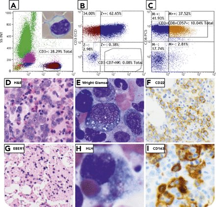 feldstej's tweet photo. #HereIsACase #enjoy #hemepath #heme #PathTwitter #meded #pathology #ForHemeTweeps #weekendread #CongratsYougen #hemefellow #HappyWeekend https://t.co/5DCsOyLryr https://t.co/zVkrOM767H