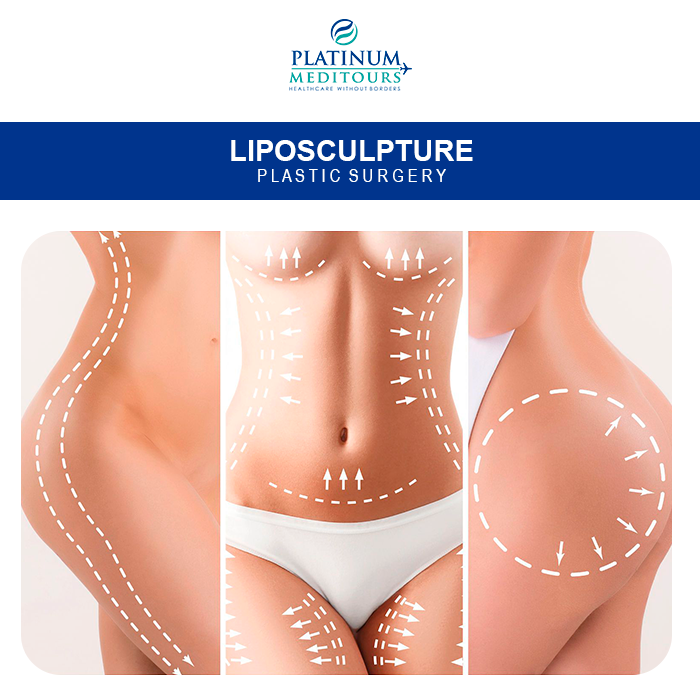 PMeditours's tweet image. #Liposculpture A good candidate for this procedure is healthy, near his or her ideal body weight, with discrete areas of unwanted fat.