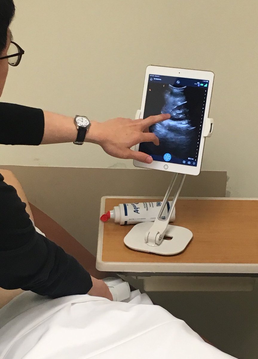BradDNichol's tweet photo. Teaching ultrasound requires a free hand to point out image quality with Clarius wireless @clariusmhealth Thank you @PhillyUltrafest @jeff_sono @JeffEMRes https://t.co/g8jwzgByEV