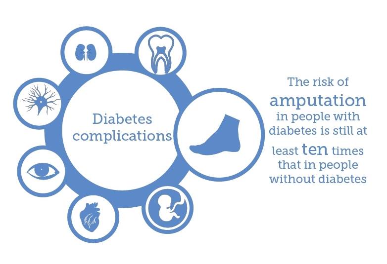 WDD's tweet photo. #DiabetesFact Every 30 seconds a lower limb is lost to #diabetes somewhere in the world. Learn more about the main complications of diabetes https://t.co/qVHvkmqQSY https://t.co/k6sLd9rA6J