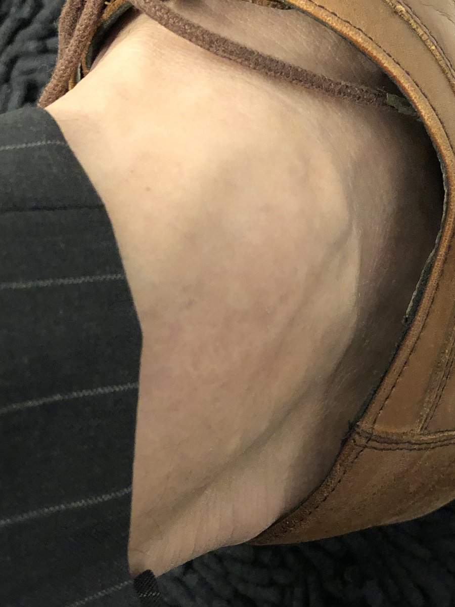 joshuaesc's tweet photo. @IVMiles I rarely wear socks #DumSpiroSpero #swanseasc https://t.co/BVT6UlzpoE