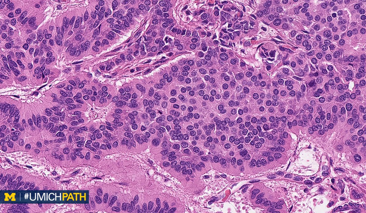 Michigan Pathology tweet media