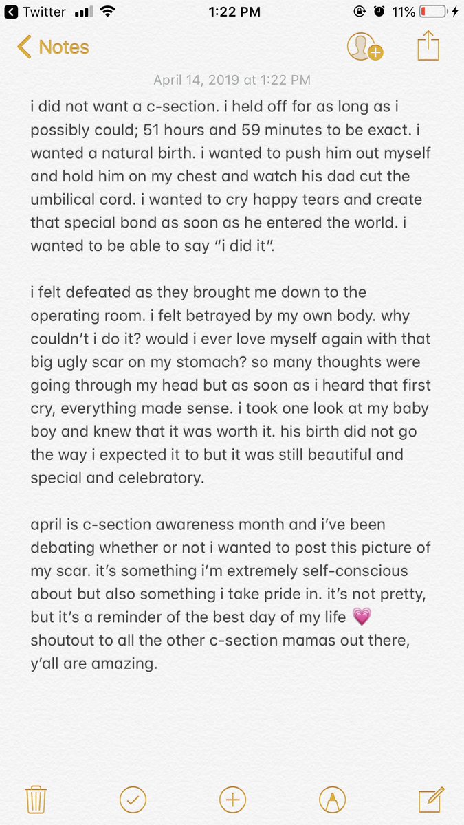 mjpeicott's tweet photo. πππ #csectionmama #csectionawareness https://t.co/1eHfWkQ374