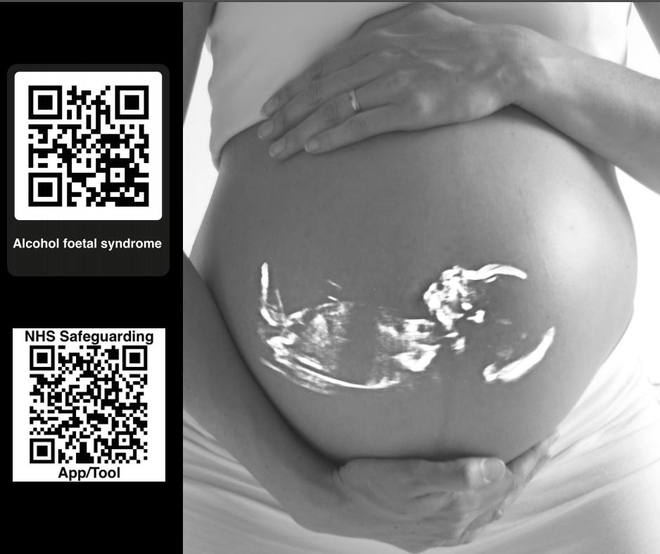 MAAPPUK's tweet photo. Are you aware of the impact #alcohol can have on your #UnbornBaby are we sharing appropriate resources to prepare, enhance knowledge, show evidence of impact?
#NHSsafeguarding
We all have a duty to safeguard, please share!
#LinkIndex
#Mums
#Pregnancy
#Midwives
#QRcoderesources https://t.co/UsfE6J2vQC