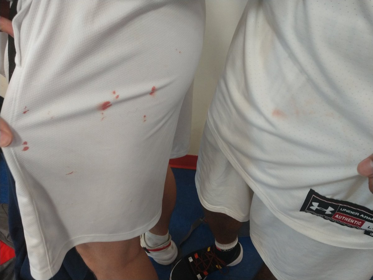 AZSelectBoysBB's tweet photo. Welcome Back to AAU Refs.....Non of These Were Called Fouls!
Happy Our 17u Boys are 3-0 so Far This Weekend.
@aau_bingo @GreggRosenberg1 @AzCoachMikeC @theShowJLVargas
#nocalls #lookedcleantome #imissedthatonecoach https://t.co/R7ndbMZtvT