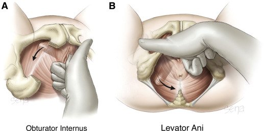 AJOG_thegray's tweet photo. #AJOG
Development of a standardized, reproducible screening examination for assessment of pelvic floor myofascial pain
https://t.co/E1EHvOpw1h https://t.co/TVwFveolpr