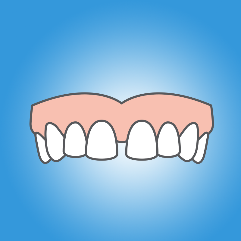 BOH Dental. bohdental.com.au/gapped-teeth-treatment. 