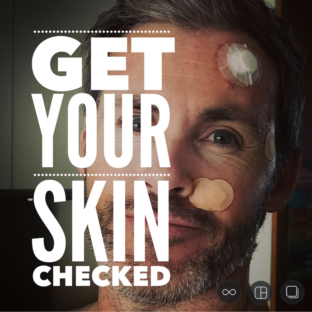 jsconditioning5's tweet photo. I deal with skin issues due to my obsession with being brown in my younger days...
It wasn’t worth it!
If you’re unsure about the various types of skin cancers, it’s best you get educated. 
If in doubt, find out!
#skincare #skincancerawareness #sundamage #skin #skinhealth https://t.co/f8z62U5uPm