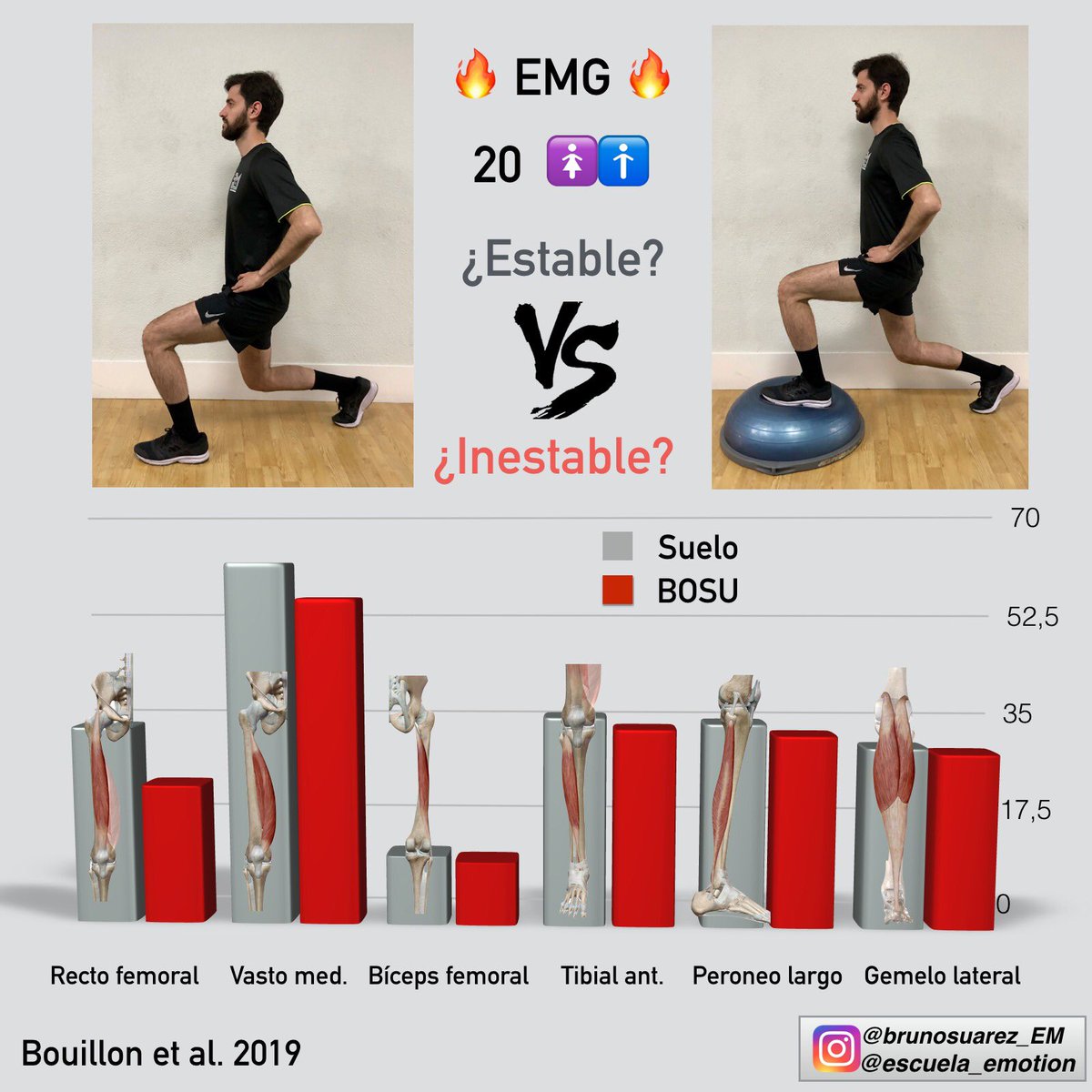 Dolor en el vasto medial causado por ciclismo – SOLESTAR, image size:1200x1200