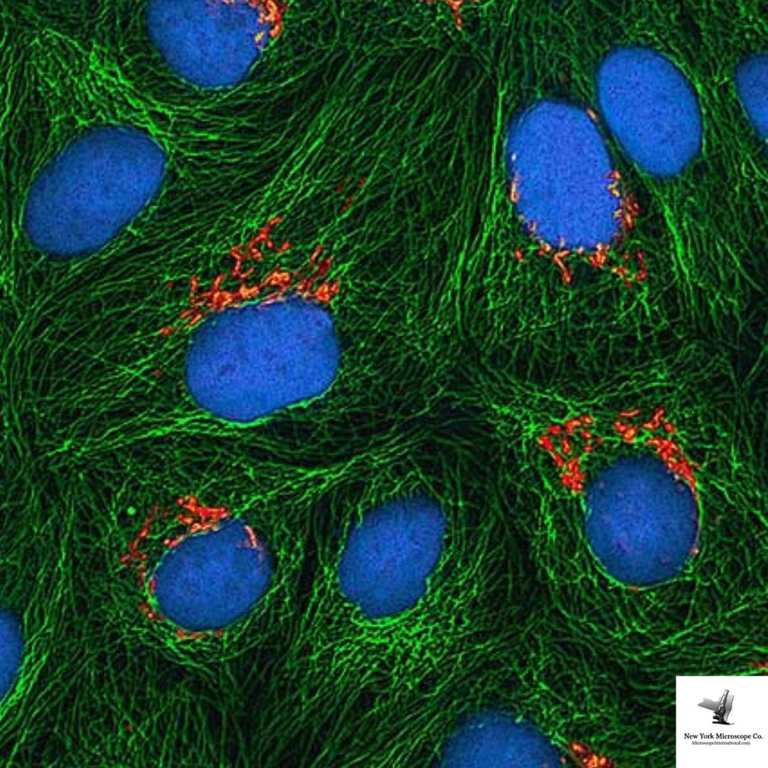 MicroscopeCo's tweet photo. To study substances present in low concentrations high-sensitivity is crucial for detection. A #fluorescencemicroscope does a neat job https://t.co/387QlHxNM0
#microscopy #research #microbiology #fluorescence #laboratory #cell #microscopic #biochemistry #immunofluorescence https://t.co/CfUJmjjNpj