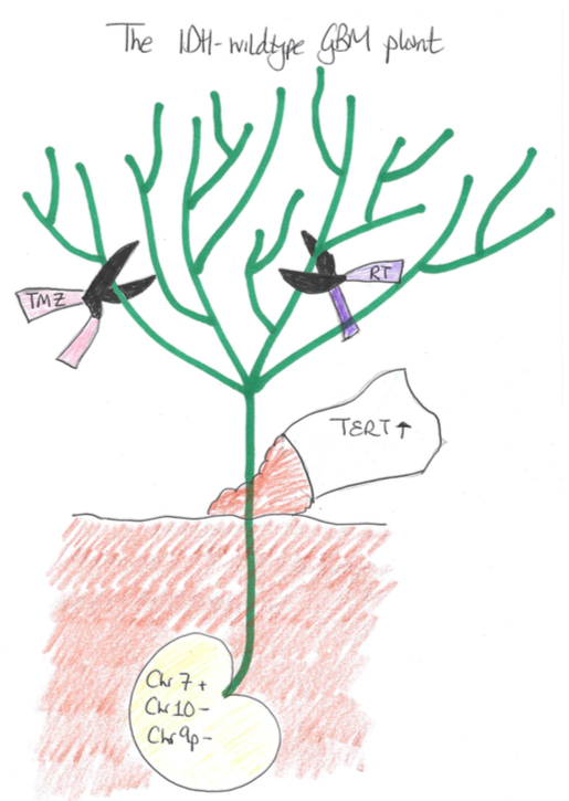 Lucy Stead (@lucyfstead) on Twitter photo Strange to see a picture I drew with my 4-year old's colouring
pens end up in a <a href="/Cancer_Cell/">Cancer Cell</a> preview bit.ly/2DejuLH! Thanks <a href="/roelverhaak/">Roel Verhaak</a> for letting me help summarise work showing how longitudinal GBMs can inform on disease progression: bit.ly/2Zf82c3 Strange to see a picture I drew with my 4-year old's colouring
pens end up in a <a href="/Cancer_Cell/">Cancer Cell</a> preview bit.ly/2DejuLH! Thanks <a href="/roelverhaak/">Roel Verhaak</a> for letting me help summarise work showing how longitudinal GBMs can inform on disease progression: bit.ly/2Zf82c3