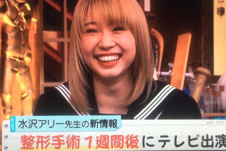 水沢アリー先生 正直 把握してないくらい 整形 してます 作られた顔とキャラで自分を見失うまでを激白 しくじり先生 Togetter