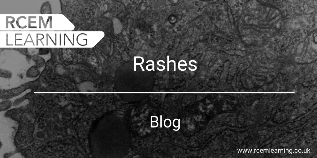 Rashes are difficult to diagnose in both children and adults. The key is to be able to identify the important types and then manage to learn about the rest slowly. 
Some typical cases of paediatric rashes in #RCEMLearning blog 👉 bit.ly/2FoT6QL #FOAMed