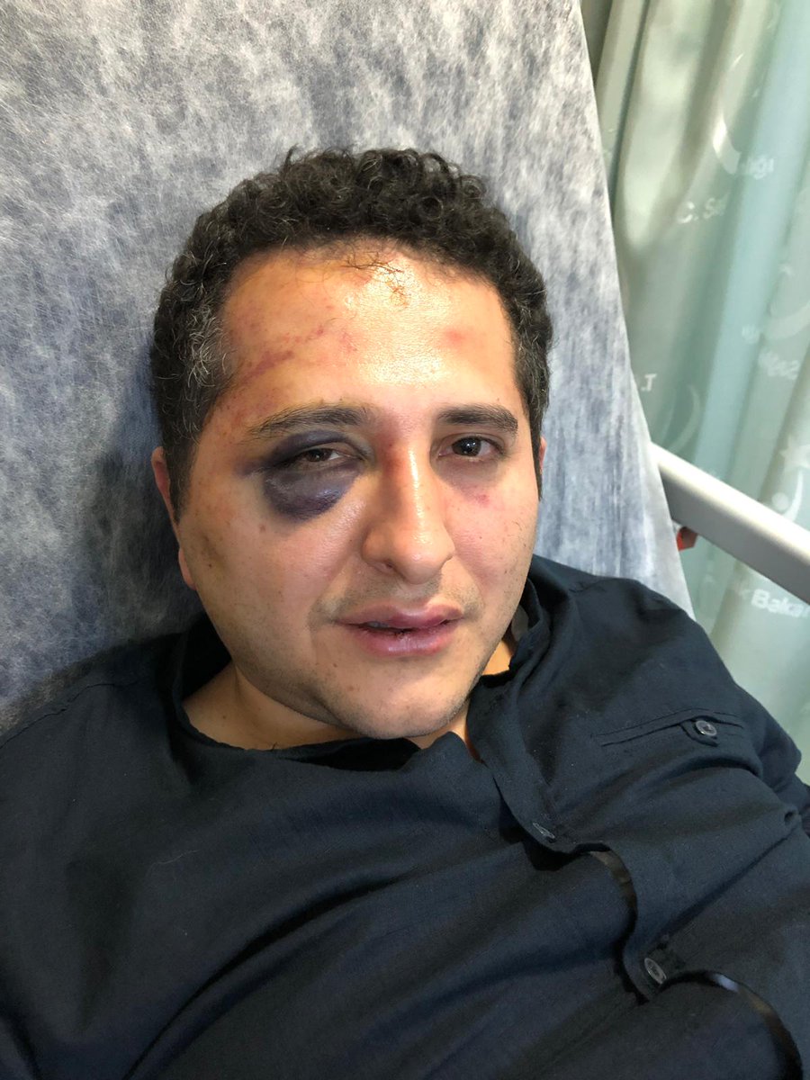 alicanuludagg's tweet photo. Çırağan Sarayı'nda iki saat işkence:

Cumhurbaşkanlığı korumaları, Çırağan'da trafiğin neden kesildiğini soran avukatı koruma aracına alıp iki saat darp etti

Bu sırada avukatın elleri arkadan kelepçelendi, gözleri bağlandı
 https://t.co/FO5esOCebb https://t.co/JhKr99svZL
