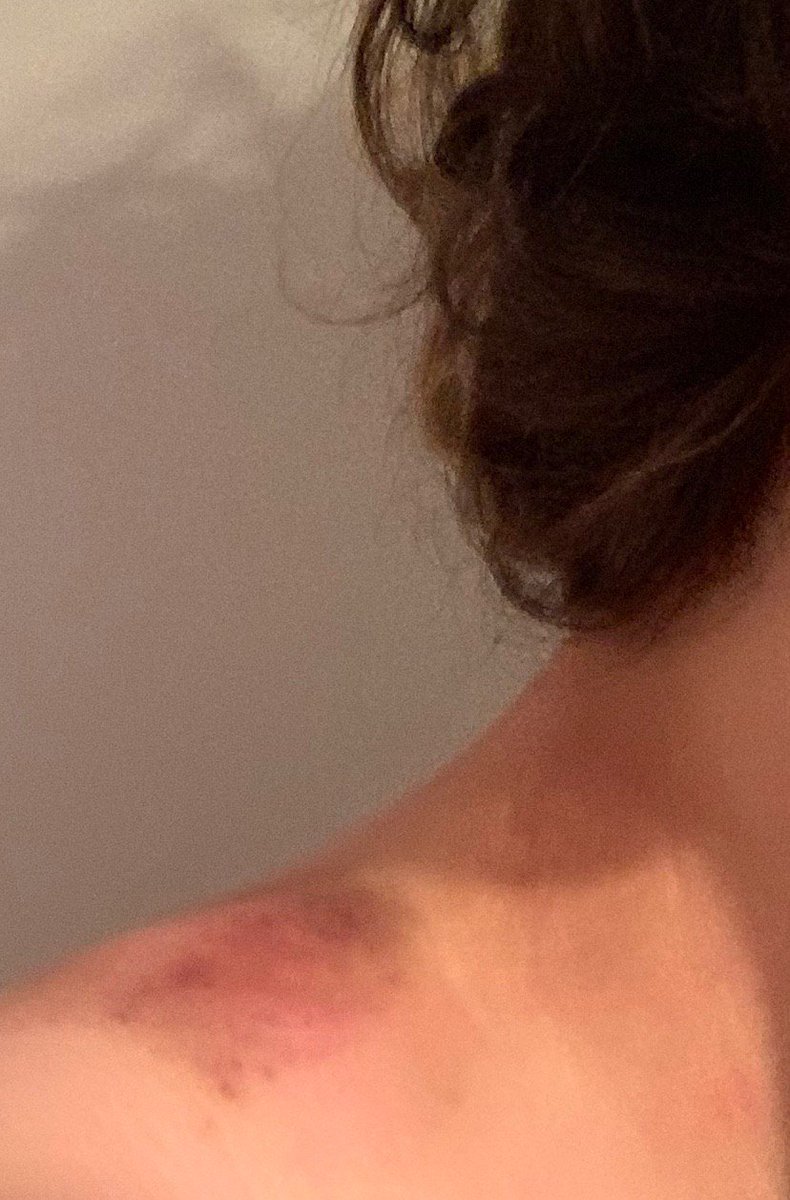 Had some fun with a super cute cheetah this weekend :3 lots of toothy deer bites