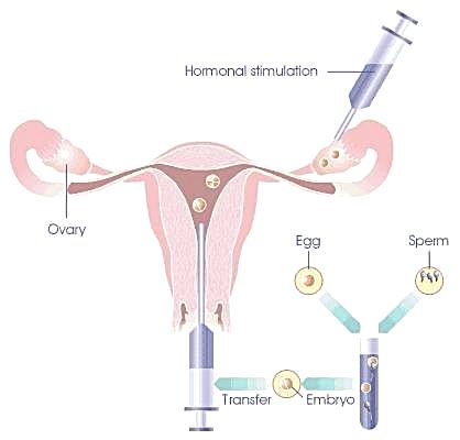 #Turkey becomes go-to destination for those #seeking #IVF #treatment
#Journal of #Women's #Health #Issues and #Care@SciTechnol #Article Submission-editor.jwhic@scitechnol.org