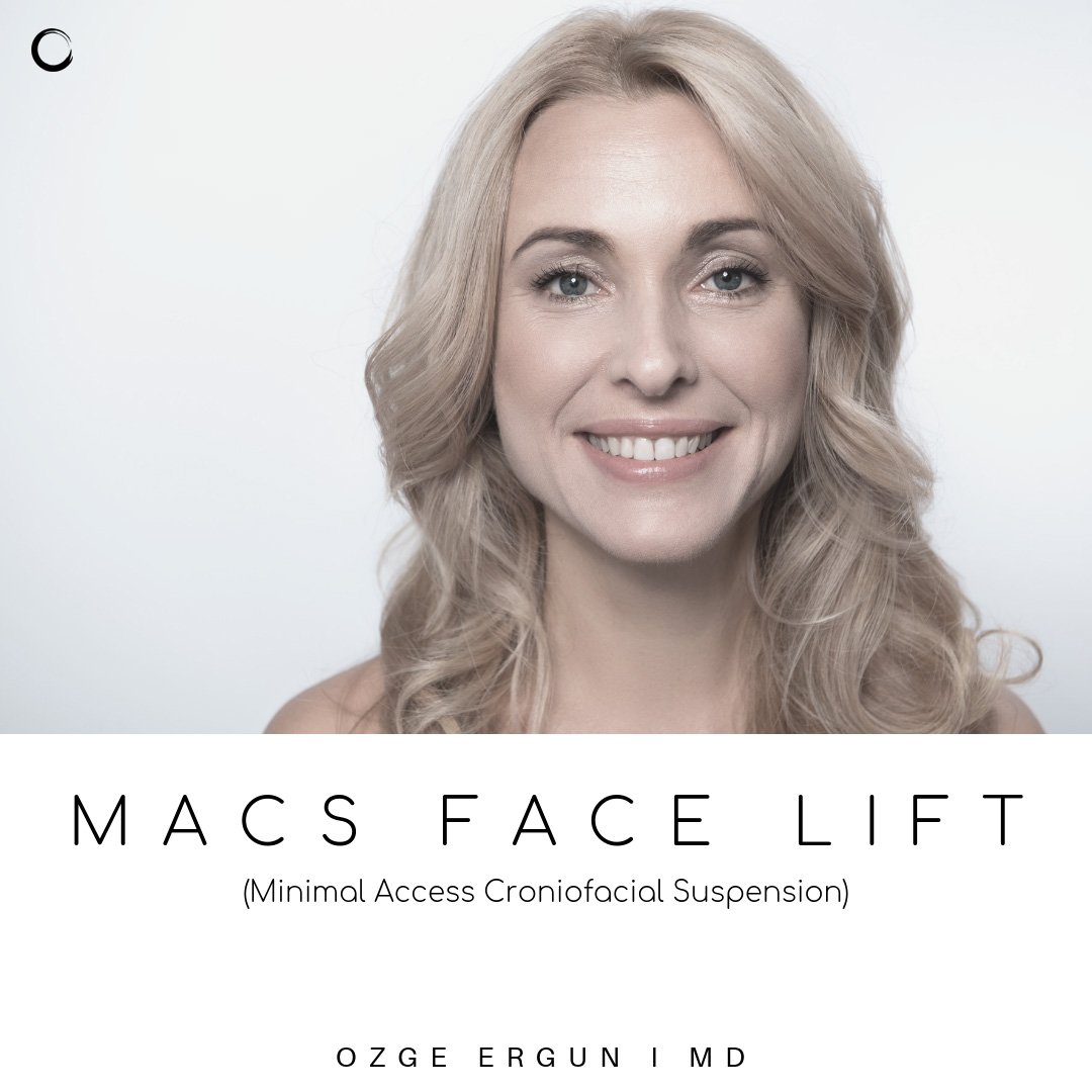 ozgeergun_md's tweet photo. Macs Face Lift
For more information 📲 WhatsApp: https://t.co/vq47jOOqEV
https://t.co/Fhcpg6CA9g
#midfacelift #macsfacelift #macslift #estiramientofacial #facialaesthetics #transformation #plasticsurgery #wrinkles #finelines #aging #treatment #yüzgerme #facelift #beautifulskin https://t.co/FTvNGGlG5I