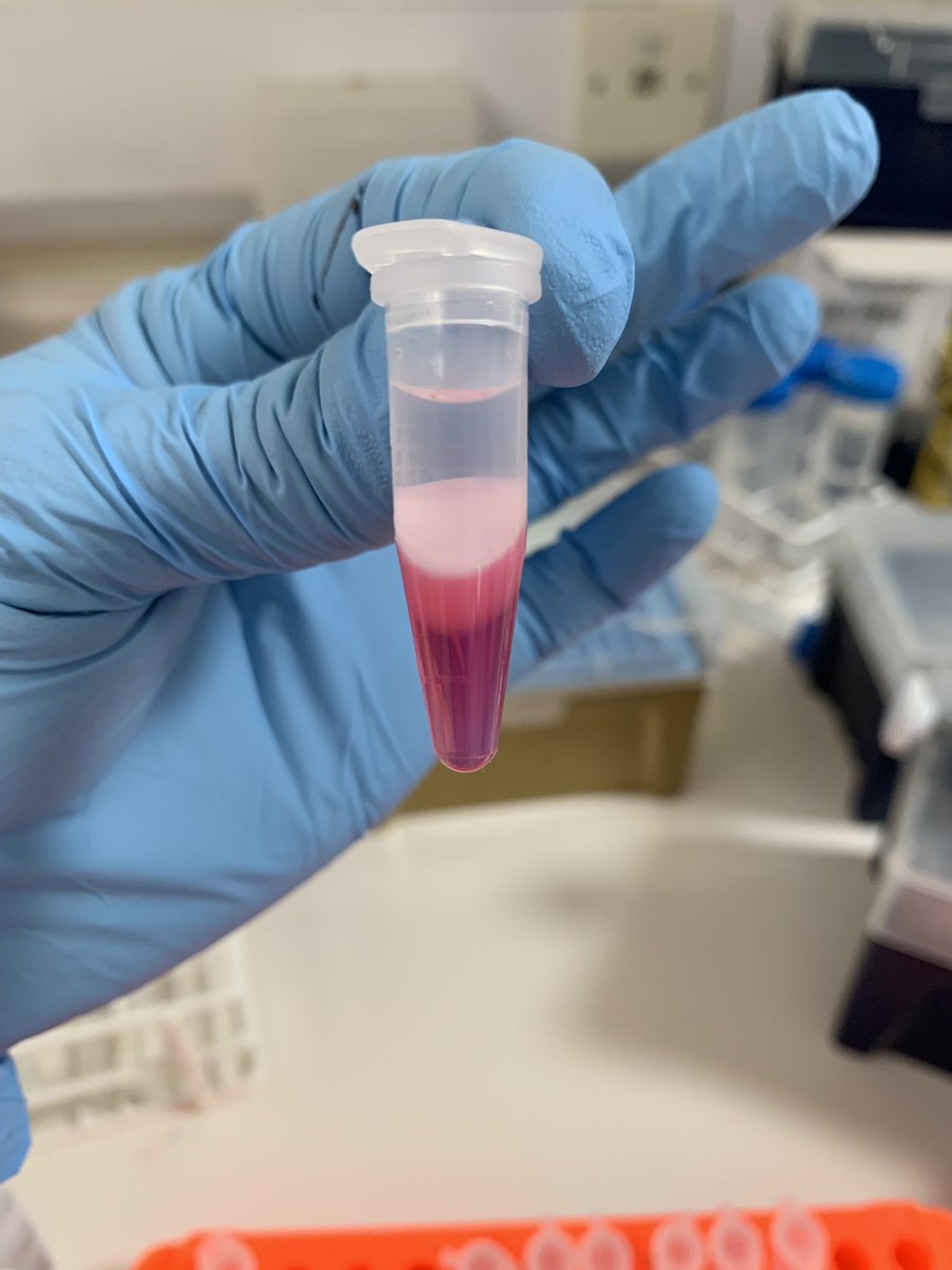 ProfAllieG's tweet photo. Had a fun &amp; productive afternoon in the lab with @CIMA_Ageing MRes student Favour extracting RNA from human bone samples! #PIintheLab #ProfintheLab #rna #bones #seemyscience #scienceisfun 2/2 https://t.co/MlhwQFwnlX