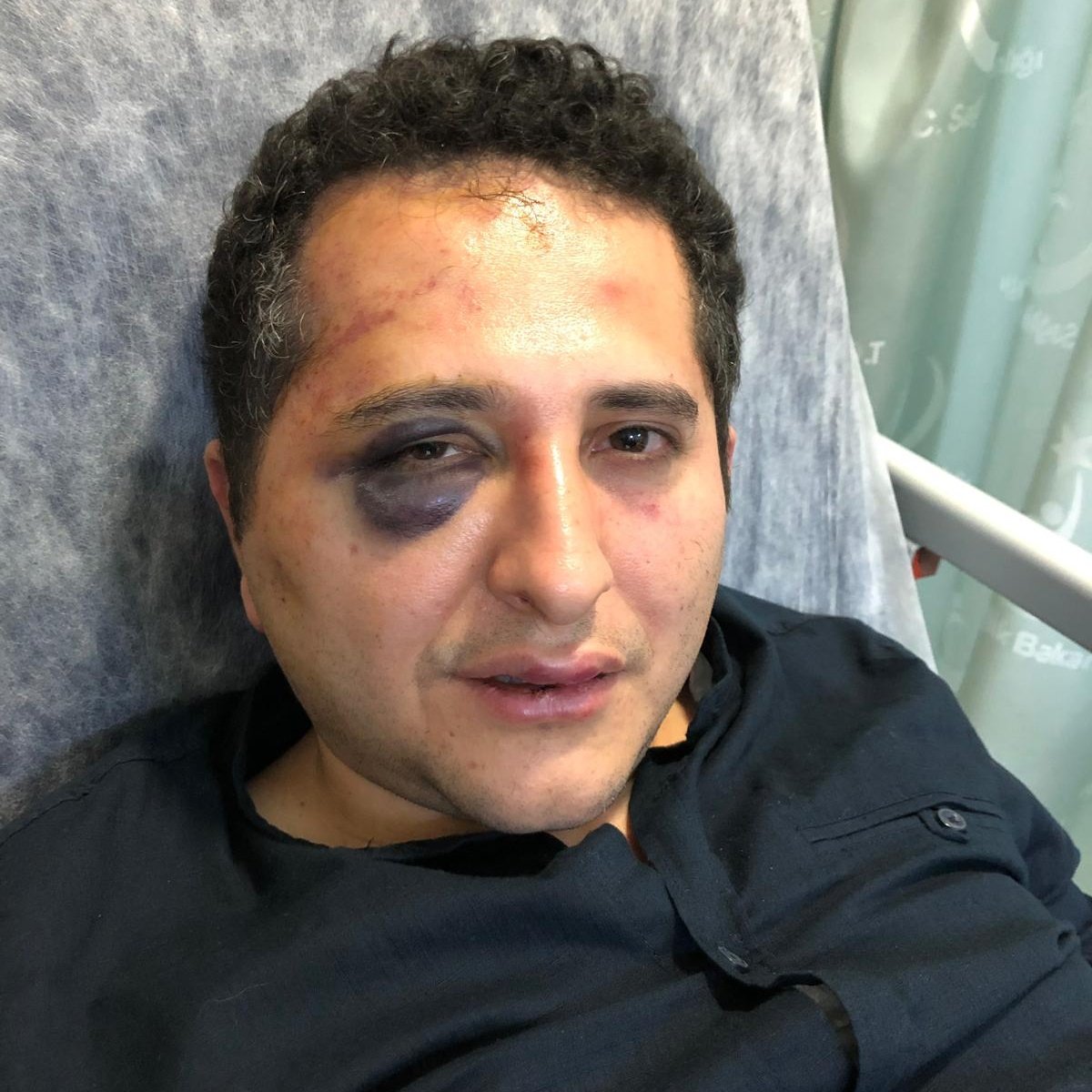 Bu ülkenin bir vatandaşı, bir avukat Çırağan Sarayı'ndaki yolun niye kapatıldığını soruyor.

Cumhurbaşkanlığı korumaları kendisini zorla alıkoyuyor. 2 saat işkence yapıyor. Zorla tutanak imzalatıyor.

Bu hepimizin yüzünü kızartacak bir vaka.  Sonuna kadar takipçisiyiz.