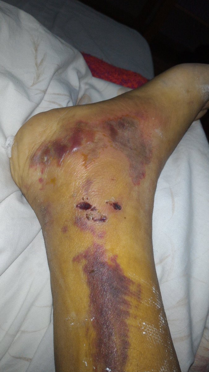 JoseLLontop17's tweet photo. @VeroLinaresC @veronicalinares @VeronicaLinares Gracias por interesarse en Mi caso y abuso y corrupcion , habiendo denunciado a Ispectoria general,solo quiero justicia ...gracias ...Mi # de celular 991059827... https://t.co/QiWbxyoKK3