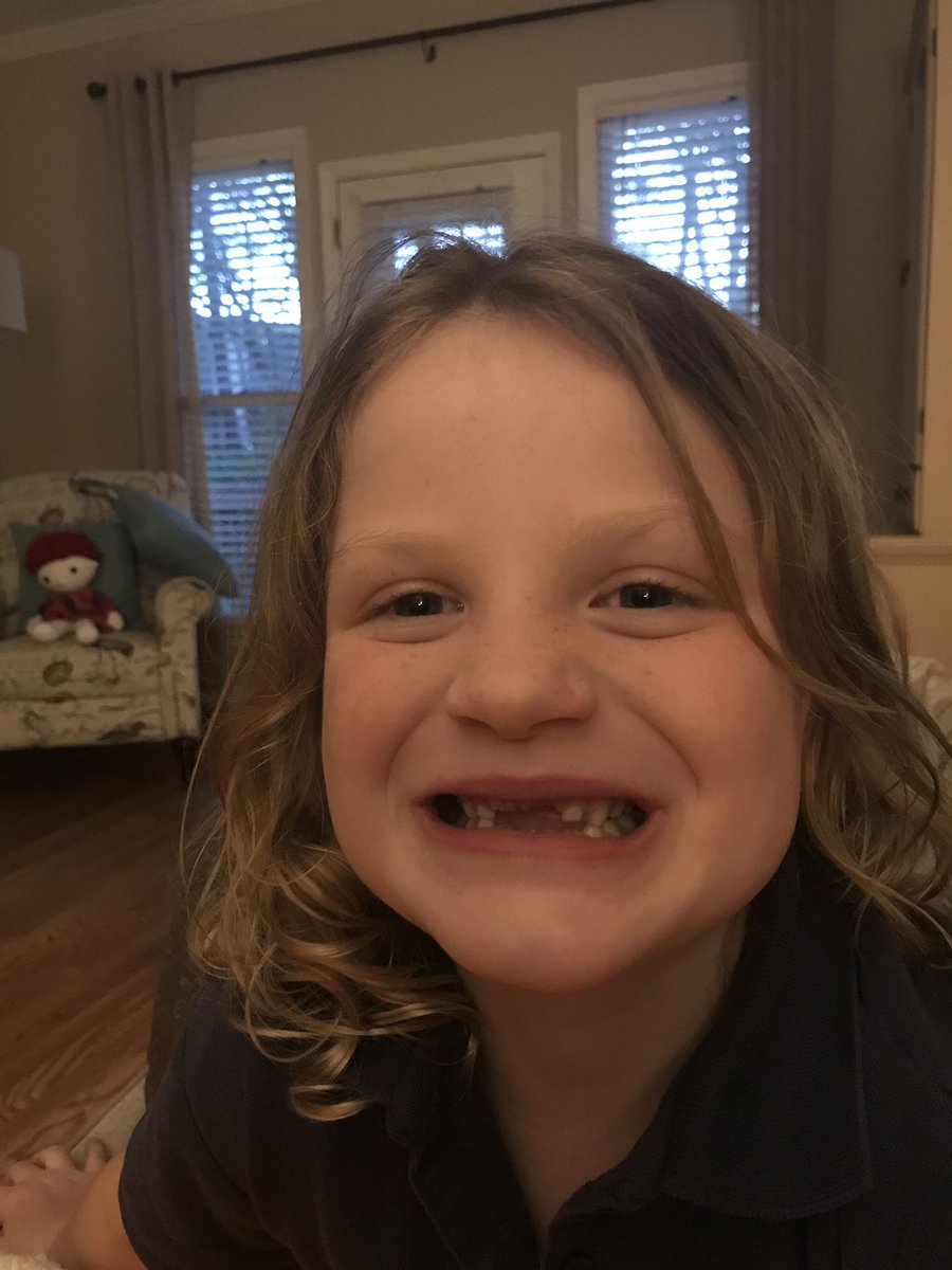 Just look at this toothless smile. Another sign my girl is growing up too quickly.