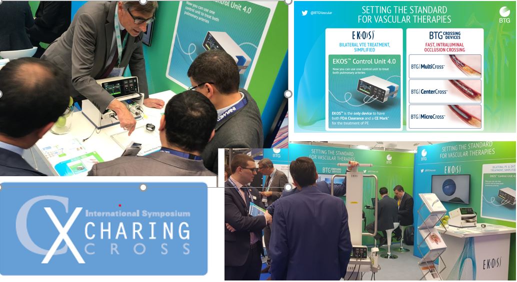 BTGVascular's tweet photo. Busy day for #BTGVascular team @CXSymposium in #London. If you would like to learn about fast, #intraluminal #occlusion crossing and discuss how bilateral #VTE treatment can be simplified visit #BTG Booth 212. #EKOSTherapy #BTGCrossingDevices https://t.co/AUZjVi9RCT