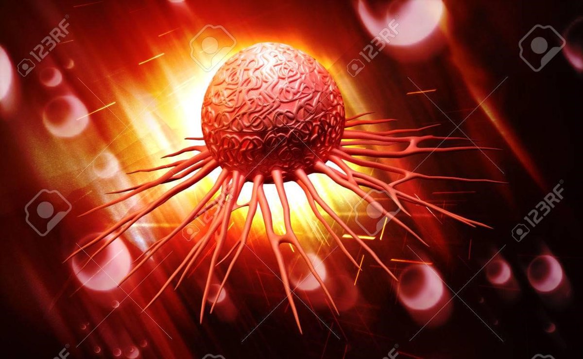 CelSciCorp's tweet photo. Head and neck cancers account for approximately 6% of cancers worldwide. Find out more about the causes and treatments available for head and neck cancers here: https://t.co/trY2ttyQFy 

Also check out: https://t.co/zRj5l1Kh5N
#CELSCI #Multikine #headandneckcancer https://t.co/xMlXju7nsN