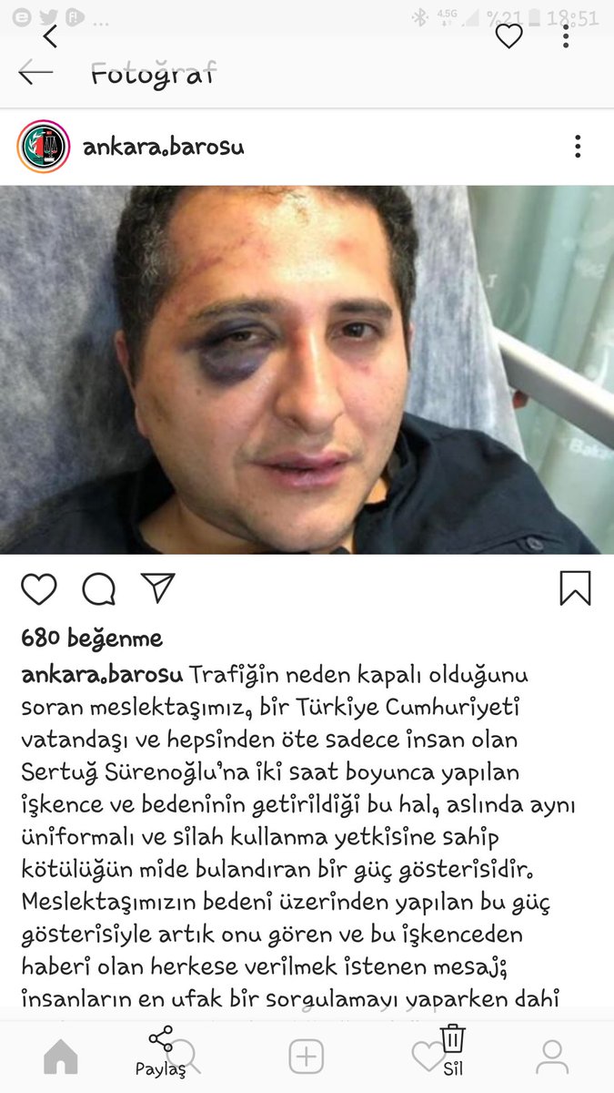 ukudirenis's tweet photo. ADALET GUCUNUZUN MEŞRU HALİDİR! 
HAK GÜCÜNÜZÜN ULASABILDIGI YERE KADAR GIDER
!
#HukukunPeşindeyiz https://t.co/lZILLEnXfZ