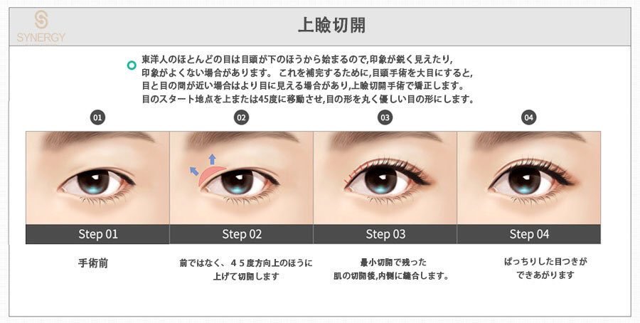 墓 真剣に奥目を改善する作戦を考えてみた あとはタレ目形成で白目の露出を増やすのも効果ありそう 目 の形によるかもだけど 奥目は目頭切開で必ず改善されるものじゃないよ 私は目頭切開2回やったけど超奥目