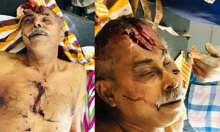 BondHakunaMtata's tweet photo. కళ్ళు మింగిన జఫ్ఫాస్ 
ఎలారా ఎలా చూస్తే యే కళ్ళతో చూస్తే ఇది గుండెనొప్పిలా కనిపిస్తుంది రా ?
@taruns_ please help us to understand https://t.co/h9sjHn6BnX
