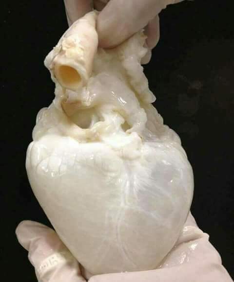 MahmoudElSafe1's tweet image. قلب الانسان بعد تصفيته من الدم والخلايا 
قد خلق الله قلبك بهذا الصفاء .. فلا تملأه الا بما هو خير 🌸
#ÊŁșafë 👌👑