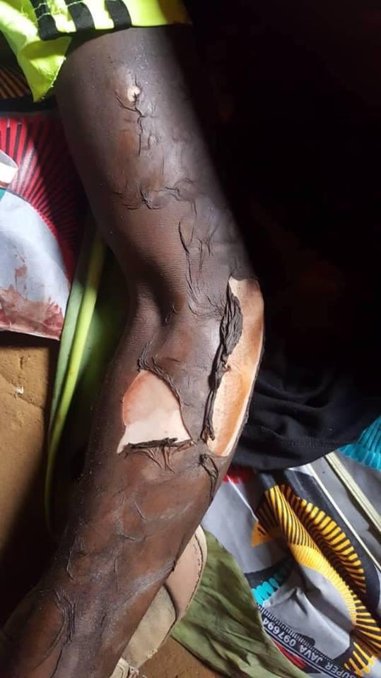 apeterbruce's tweet photo. @LeymahRGbowee  Mix carefully #HumanWrongs, #Genocide, #WarCrimes, #corruption, #LiesTelling, u've #cameroUn. Venting in2 any biz wt dem might put #womenpeacesecurity prog. @AC4Columbia reputation @risk. #NotreDameCathedralFire is just an object> #Ambazonians r burnt alive daily. https://t.co/tUFDMILIsr