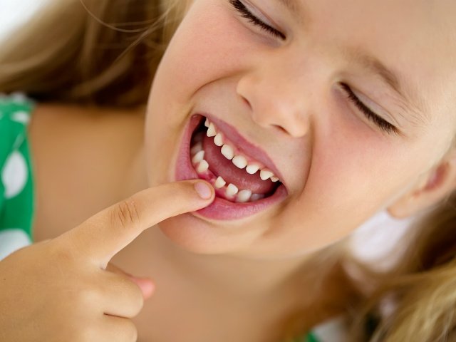 DentistryTfi's tweet photo. #Children generally lose their front 8 #babyteeth between six- eight years of age. At this time the first permanent #molars will also come through behind the #baby #teeth. Then between ten-twelve years of age the remaining baby teeth are lost and are replaced with #adultteeth. https://t.co/Gr9KSb5oL3