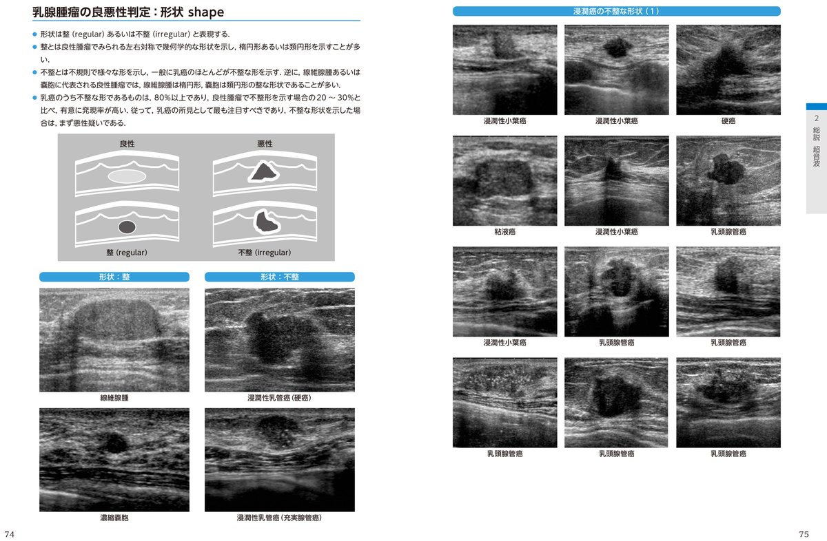 Dr.辻本の乳腺診断 カテゴリー分類US vs MMG Dr.辻本の乳腺診断2:総説+カテゴリー分類 MMG vs US | 辻本文雄 |本