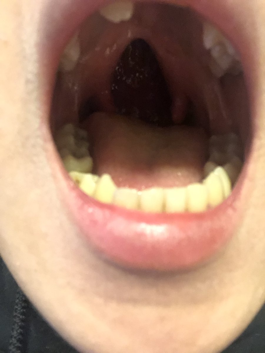 とっしー きんふんぱーりー 口の中にマンタがいます