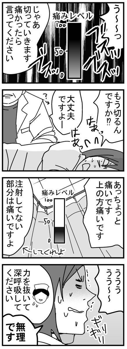 嵌頓痔核になった話４。手術（前編）
絶対肛門終わったと思ったけど、先生や看護師さんはとても淡々としていました。
出産経験ある私でも声が出るくらい痛かったです。
続きは明日アップします。 