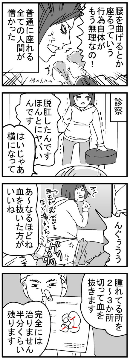 嵌頓痔核になった話４。手術（前編）
絶対肛門終わったと思ったけど、先生や看護師さんはとても淡々としていました。
出産経験ある私でも声が出るくらい痛かったです。
続きは明日アップします。 