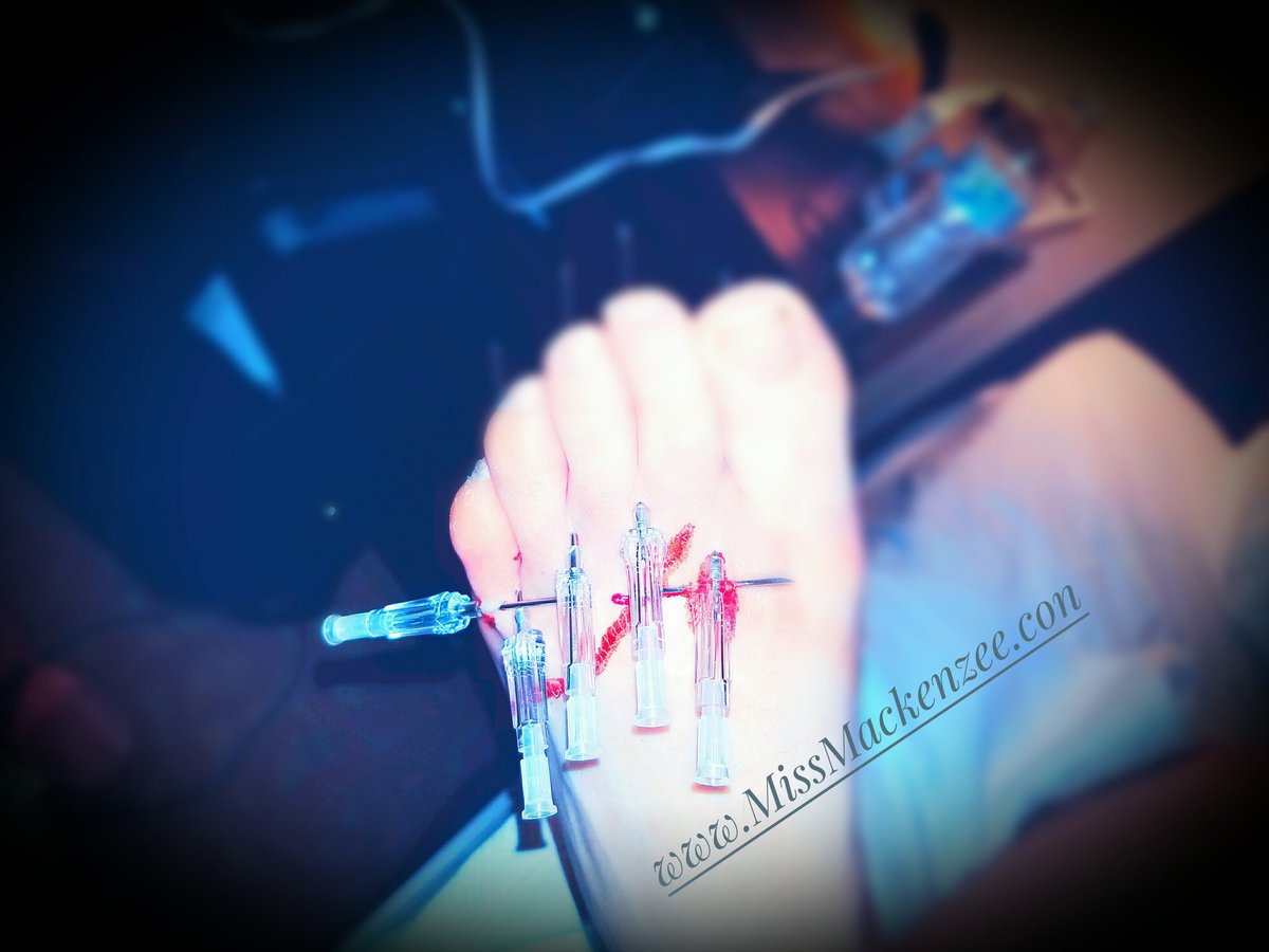 MissMackenzee's tweet photo. That moment after someone says "Go as hard as you want with me. I LOVE needles." (Devilish grin)
#needleplay #sharpsplay #bloodplay #BDSM #Sadist #masochist #energyplay #10gauges #wolverinelook #creativeSadist #sadisticMistress #funwithneedles #endorphinrush https://t.co/2PzpxpUrLL
