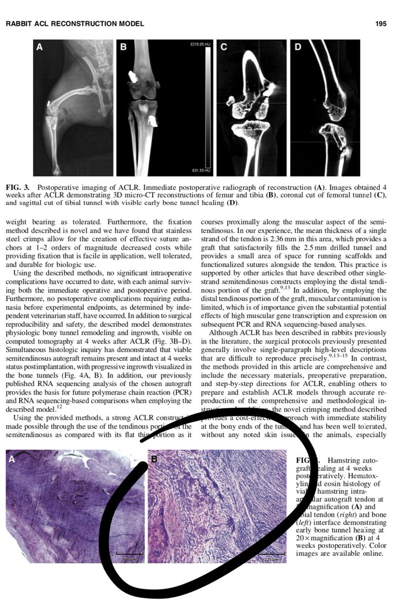 MarioHevesiMD's tweet photo. Hot off the press in #TissueEngineeringPartC and chosen for the cover art as well.  Our Figure 4 never looked so good!  #ACL #TERMIS

@sarisnl @DrKrych @sanjkakar @Hewett1Tim @ADudakovicPhD https://t.co/az1oPhEYlT
