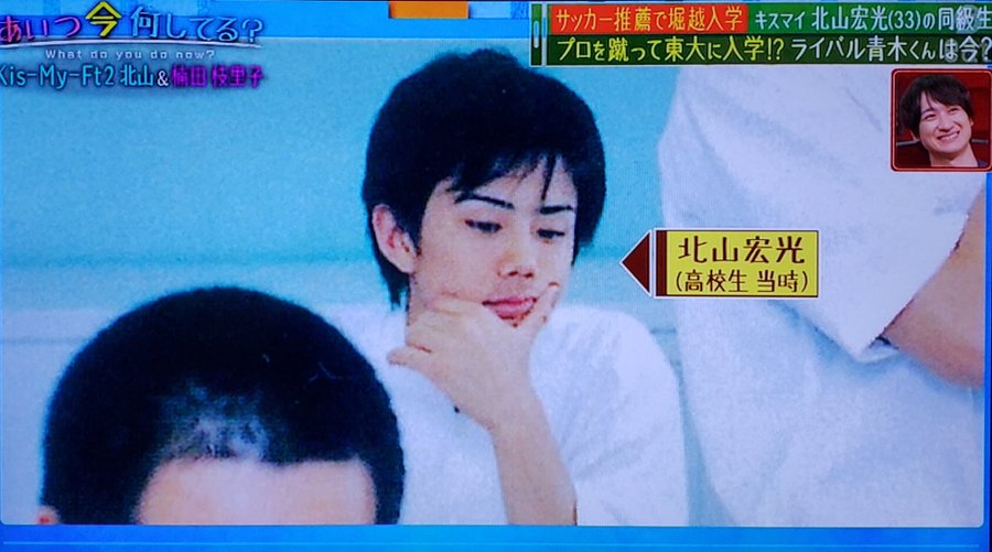 北山宏光はブサイク 性格が悪いってホント アレさえあればイケメンだった 憧れは流星のように