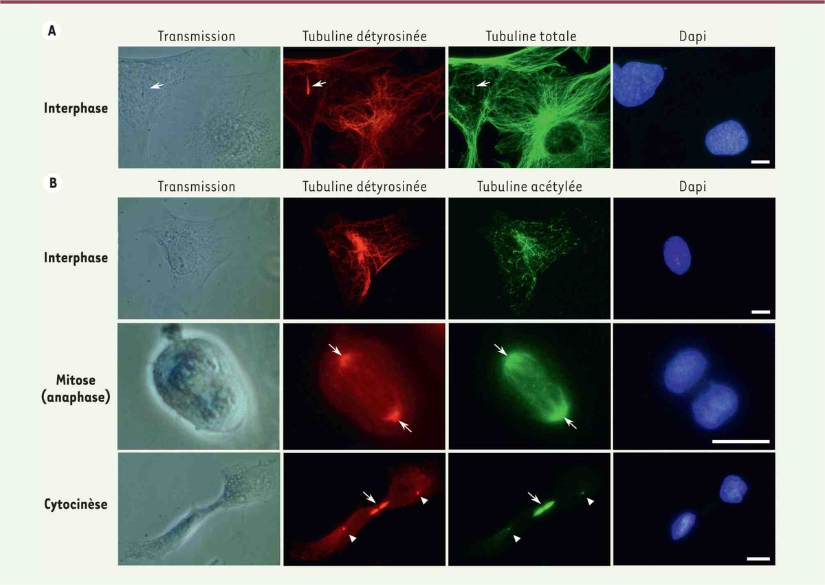 UpbmAsso's tweet photo. #cytosquelette
Déchiffrage du code #tubuline: le voile se lève sur le rôle de l’acétylation et de la détyrosination
@ms_MedSci https://t.co/aohFhTaWxq https://t.co/1XP5QHxRfN